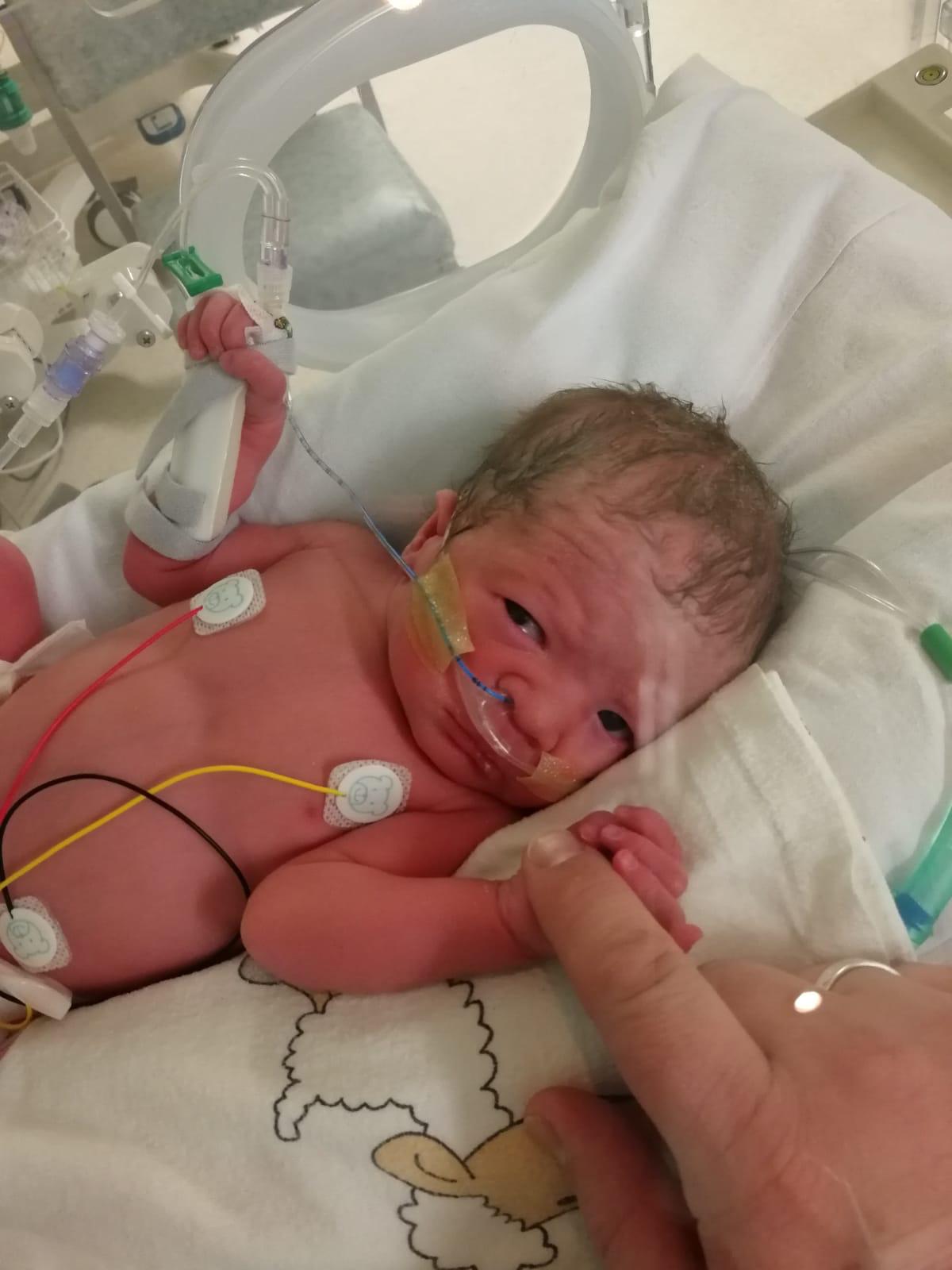 Baby Ailsa receiving neonatal care